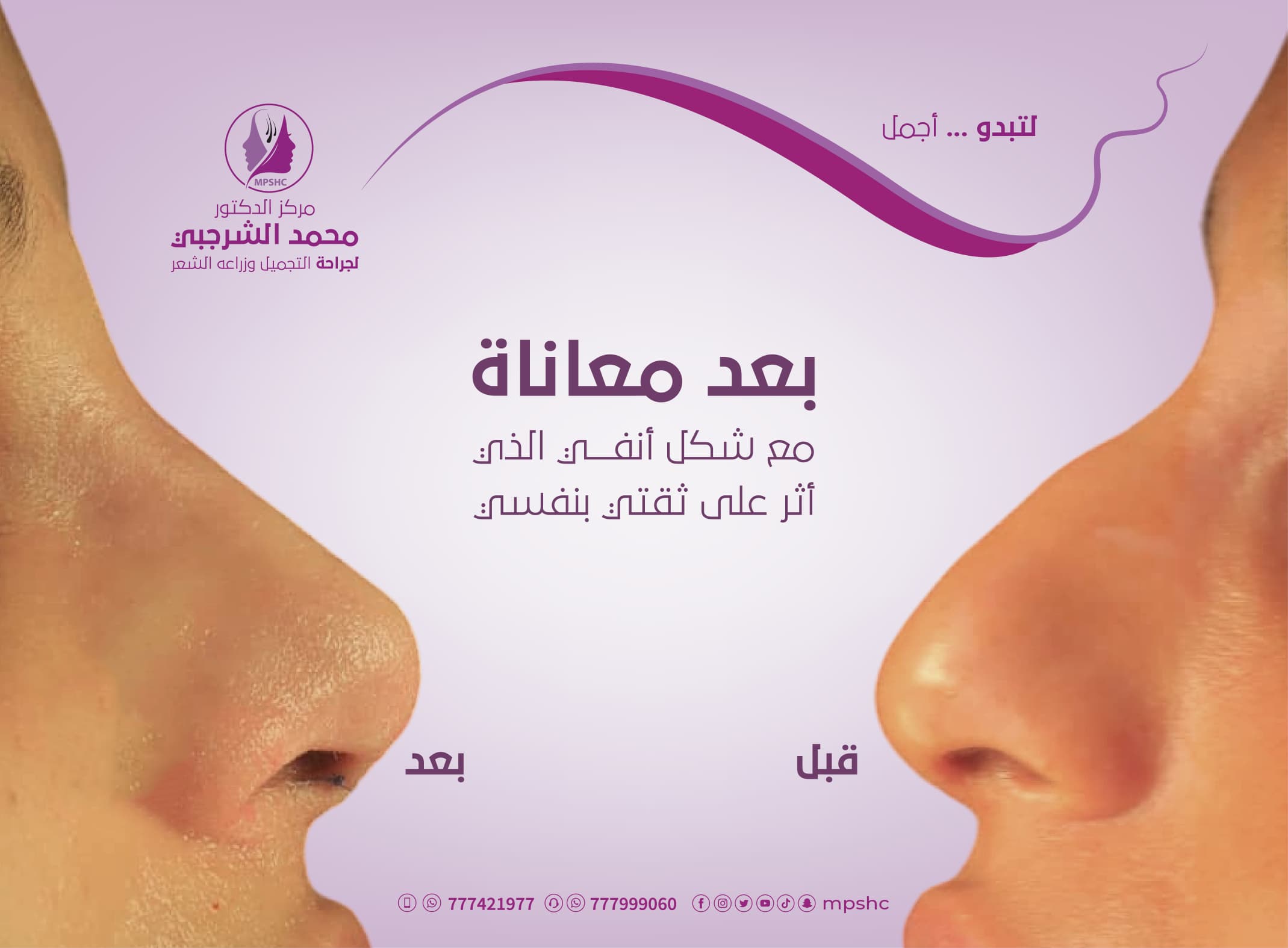 تجميل الأنف